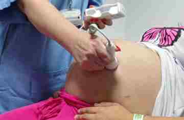  Ultrassom morfológico passa a ser ofertado a 100% das gestantes atendidas no Paraná 